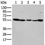 PFKFB3 Antibody from Signalway Antibody (43773) - Antibodies.com