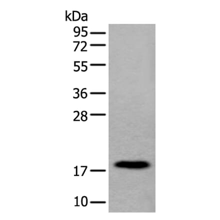 MYL12B Antibody from Signalway Antibody (43795) - Antibodies.com
