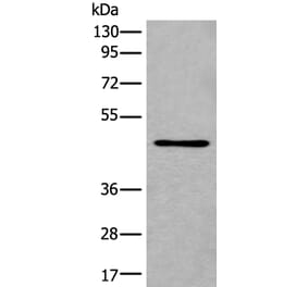 B3GNT3 Antibody from Signalway Antibody (43842) - Antibodies.com