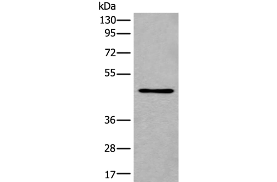 B3GNT3 Antibody from Signalway Antibody (43842) - Antibodies.com