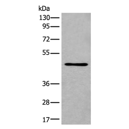 B3GNT3 Antibody from Signalway Antibody (43842) - Antibodies.com