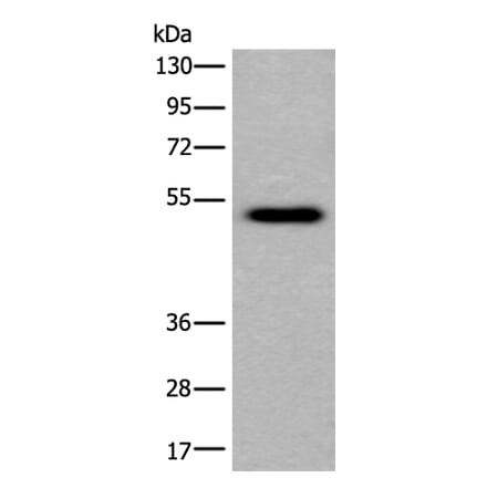 CELF5 Antibody from Signalway Antibody (43855) - Antibodies.com