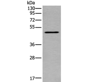 TRDMT1 Antibody from Signalway Antibody (43904) - Antibodies.com