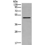 TRDMT1 Antibody from Signalway Antibody (43904) - Antibodies.com
