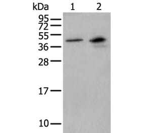 MAGEB1 Antibody from Signalway Antibody (43948) - Antibodies.com