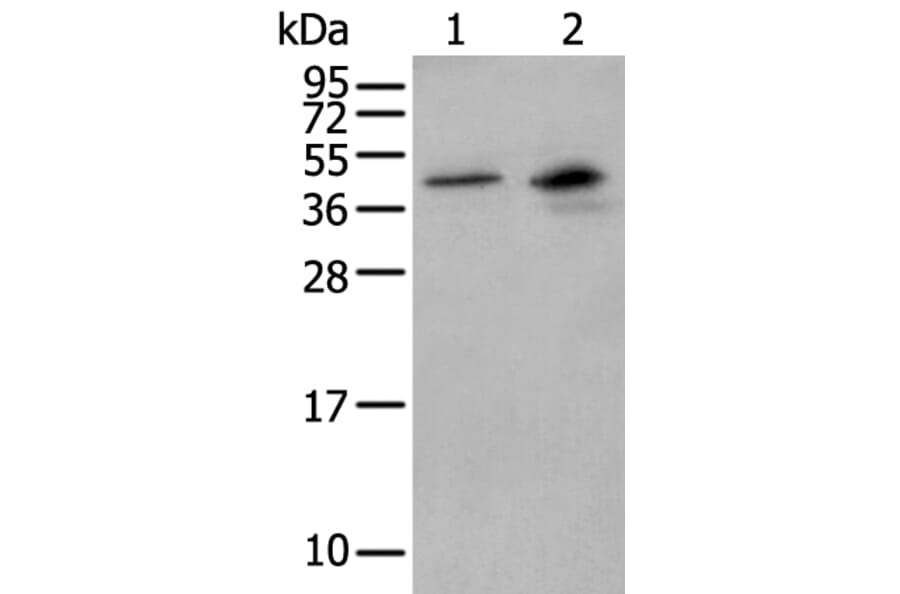 MAGEB1 Antibody from Signalway Antibody (43948) - Antibodies.com