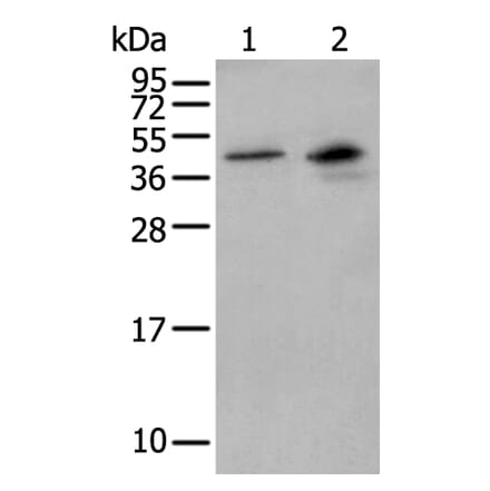 MAGEB1 Antibody from Signalway Antibody (43948) - Antibodies.com