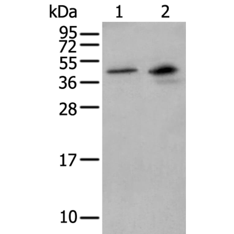 MAGEB1 Antibody from Signalway Antibody (43948) - Antibodies.com