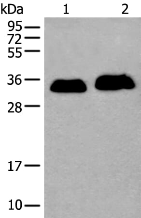 Gel: 12% SDS-PAGE Lysate: 40 &#956;g, Lane 1-2: Human cerebella tissue and K562 cell lysates, Primary antibody: ATP1B2 antibody at dilution 1/350, Secondary antibody: Goat anti rabbit IgG at 1/8000 dilution, Exposure time: 15 seconds