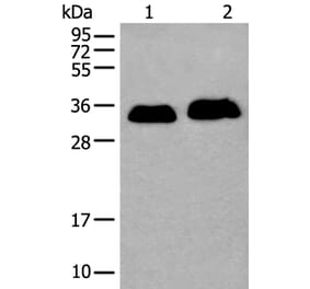 ATP1B2 Antibody from Signalway Antibody (43972) - Antibodies.com