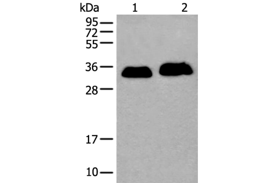 ATP1B2 Antibody from Signalway Antibody (43972) - Antibodies.com