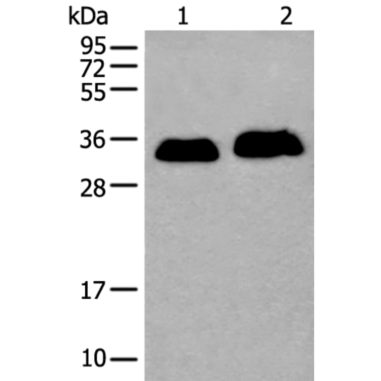ATP1B2 Antibody from Signalway Antibody (43972) - Antibodies.com