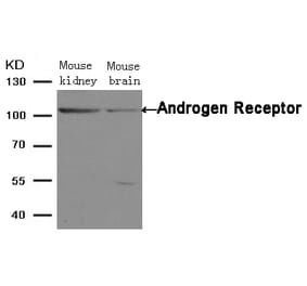 Western blot - Androgen Receptor (Ab-650) Antibody from Signalway Antibody (21105) - Antibodies.com