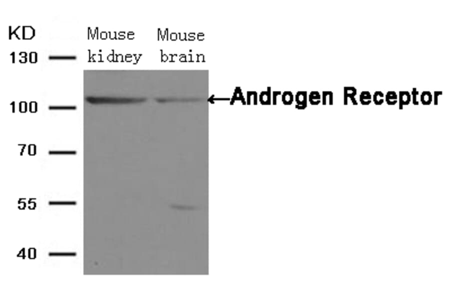 Western blot - Androgen Receptor (Ab-650) Antibody from Signalway Antibody (21105) - Antibodies.com