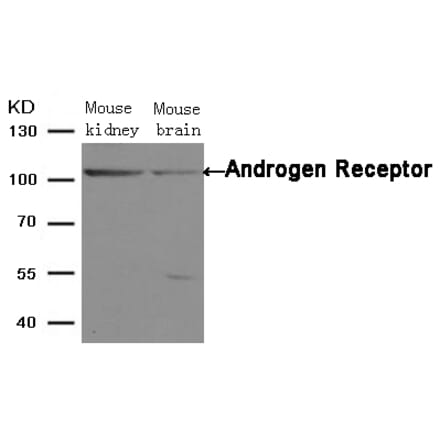 Western blot - Androgen Receptor (Ab-650) Antibody from Signalway Antibody (21105) - Antibodies.com