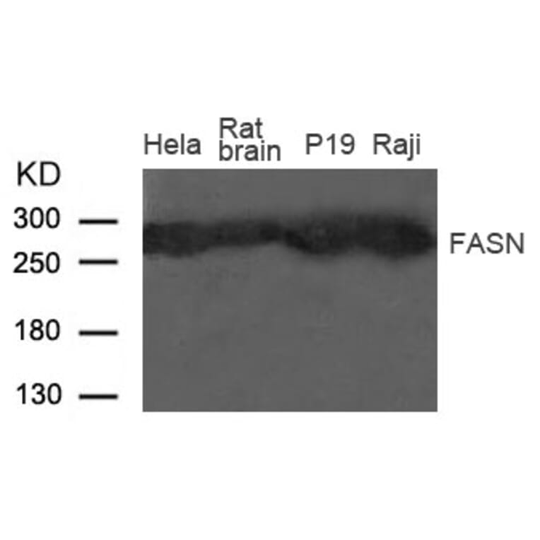 Western blot - Fatty Acid Synthase (FASN) Antibody from Signalway Antibody (21605) - Antibodies.com