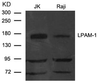 Western blot analysis of extract from JK and Raji cells using LPAM-1 (Integrin a4, CD49d) Antibody #21616