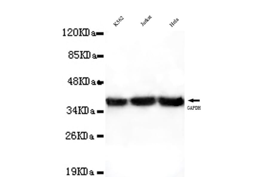 GAPDH (Internal) Monoclonal Antibody from Signalway Antibody (27031) - Antibodies.com