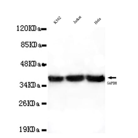GAPDH (Internal) Monoclonal Antibody from Signalway Antibody (27031) - Antibodies.com