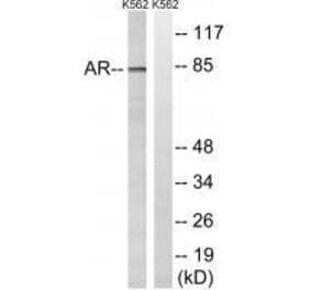 Western blot - Androgen Receptor (Ab-363) Antibody from Signalway Antibody (33255) - Antibodies.com