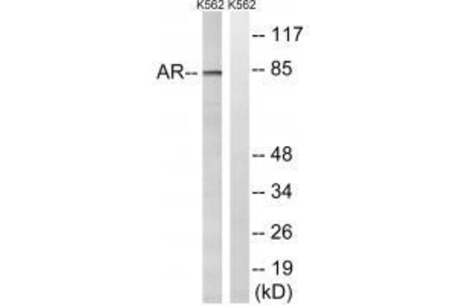 Western blot - Androgen Receptor (Ab-363) Antibody from Signalway Antibody (33255) - Antibodies.com