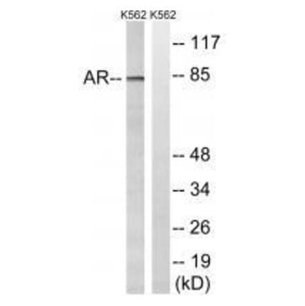 Western blot - Androgen Receptor (Ab-363) Antibody from Signalway Antibody (33255) - Antibodies.com