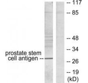 Western blot - Prostate Stem Cell Antigen Antibody from Signalway Antibody (33476) - Antibodies.com