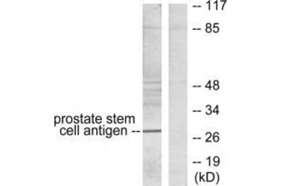 Western blot - Prostate Stem Cell Antigen Antibody from Signalway Antibody (33476) - Antibodies.com