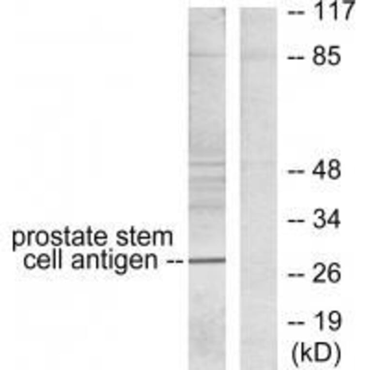 Western blot - Prostate Stem Cell Antigen Antibody from Signalway Antibody (33476) - Antibodies.com