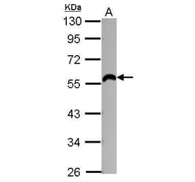 beta 2 Adrenergic Receptor Antibody from Signalway Antibody (35438) - Antibodies.com