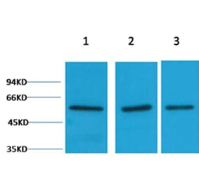 Western blot - Vimentin Rabbit Polyclonal Antibody from Signalway Antibody (38104) - Antibodies.com