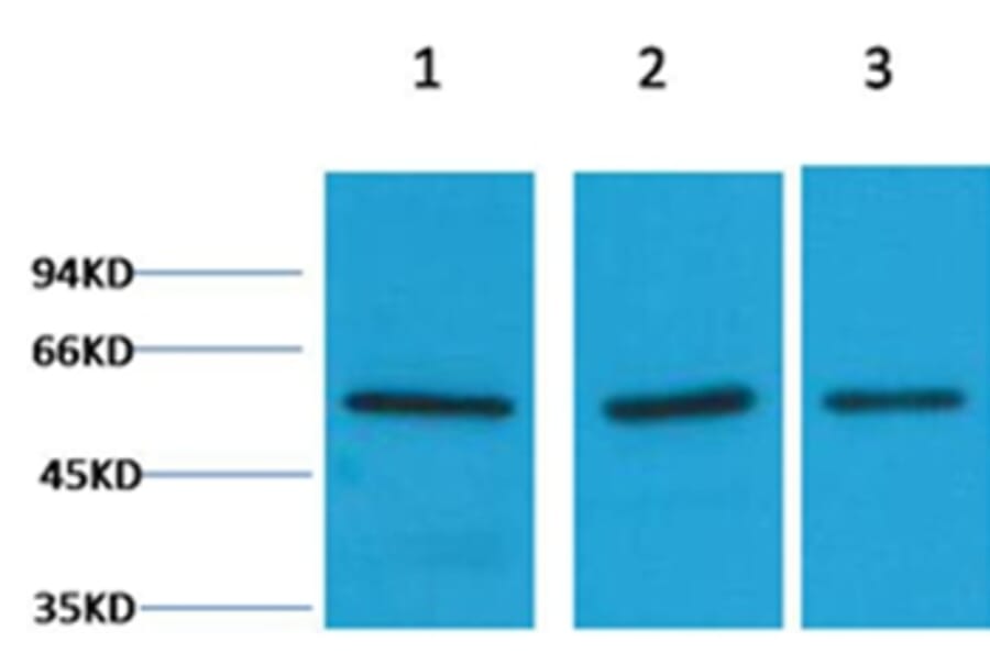 Western blot - Vimentin Rabbit Polyclonal Antibody from Signalway Antibody (38104) - Antibodies.com