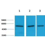 Western blot - Vimentin Rabbit Polyclonal Antibody from Signalway Antibody (38104) - Antibodies.com
