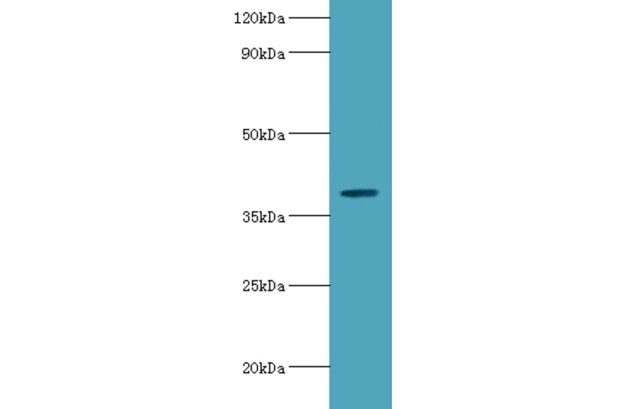 Arylsulfatase B Polyclonal Antibody from Signalway Antibody (42072) - Antibodies.com