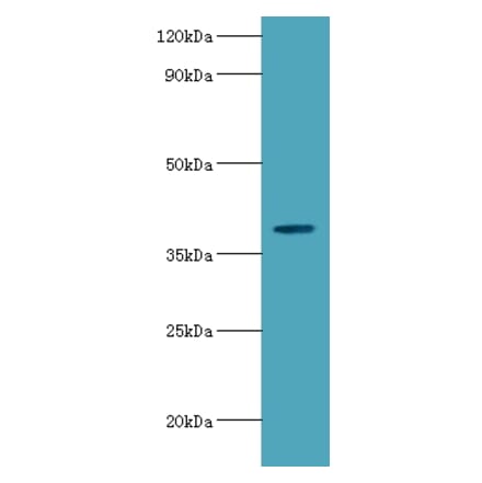 Arylsulfatase B Polyclonal Antibody from Signalway Antibody (42072) - Antibodies.com