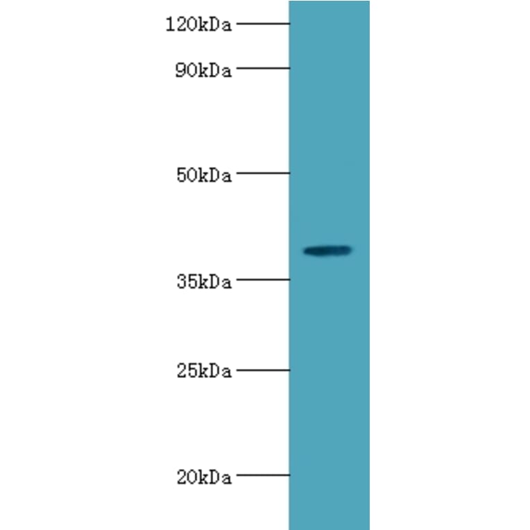 Arylsulfatase B Polyclonal Antibody from Signalway Antibody (42072) - Antibodies.com