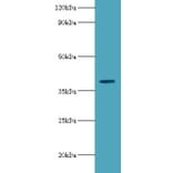 Arylsulfatase B Polyclonal Antibody from Signalway Antibody (42072) - Antibodies.com
