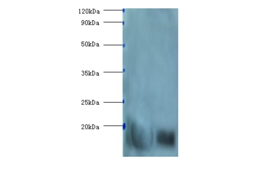 β-Lactoglobulin Polyclonal Antibody from Signalway Antibody (42085) - Antibodies.com