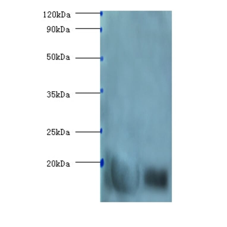 β-Lactoglobulin Polyclonal Antibody from Signalway Antibody (42085) - Antibodies.com