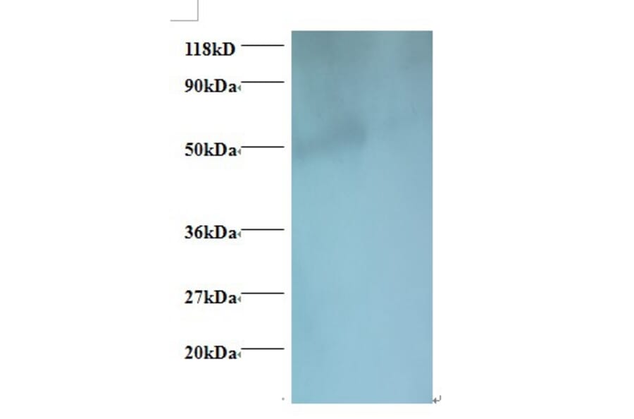 igg heavy chain Polyclonal Antibody from Signalway Antibody (42160) - Antibodies.com