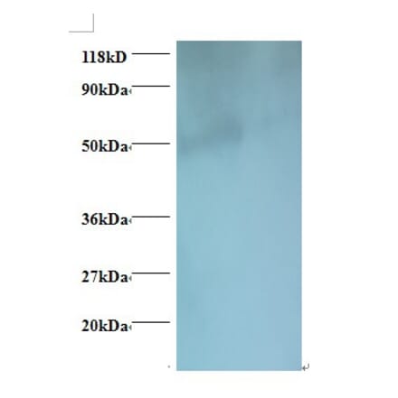 igg heavy chain Polyclonal Antibody from Signalway Antibody (42160) - Antibodies.com