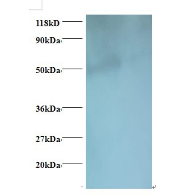 igg heavy chain Polyclonal Antibody from Signalway Antibody (42160) - Antibodies.com