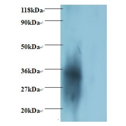 igg light chain Polyclonal Antibody from Signalway Antibody (42162) - Antibodies.com