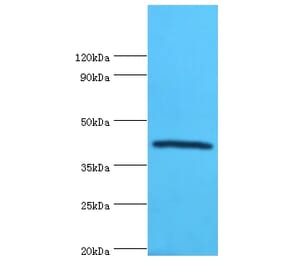 Selenoprotein P Polyclonal Antibody from Signalway Antibody (42319) - Antibodies.com