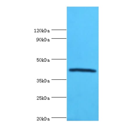 Selenoprotein P Polyclonal Antibody from Signalway Antibody (42319) - Antibodies.com