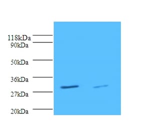 Tryptase beta-2 Polyclonal Antibody from Signalway Antibody (42352) - Antibodies.com