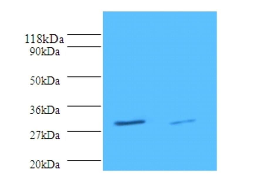 Tryptase beta-2 Polyclonal Antibody from Signalway Antibody (42352) - Antibodies.com