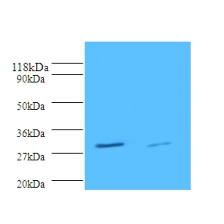 Tryptase beta-2 Polyclonal Antibody from Signalway Antibody (42352) - Antibodies.com