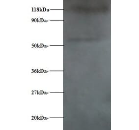 Alpha-synuclein Polyclonal Antibody from Signalway Antibody (42472) - Antibodies.com