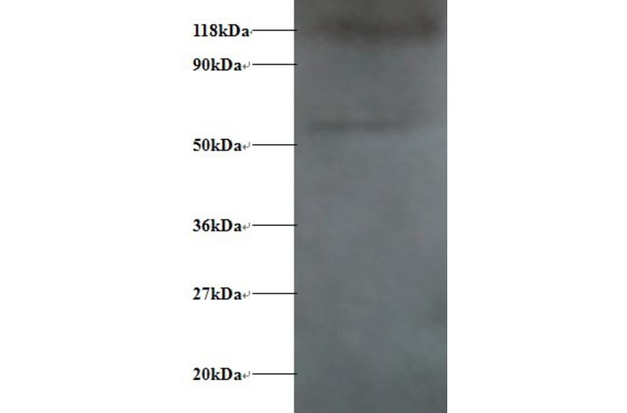 Alpha-synuclein Polyclonal Antibody from Signalway Antibody (42472) - Antibodies.com
